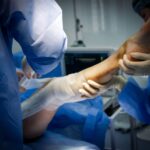 Equipe médica em cirurgia ortopédica de joelho após plano de saúde negar artroplastia