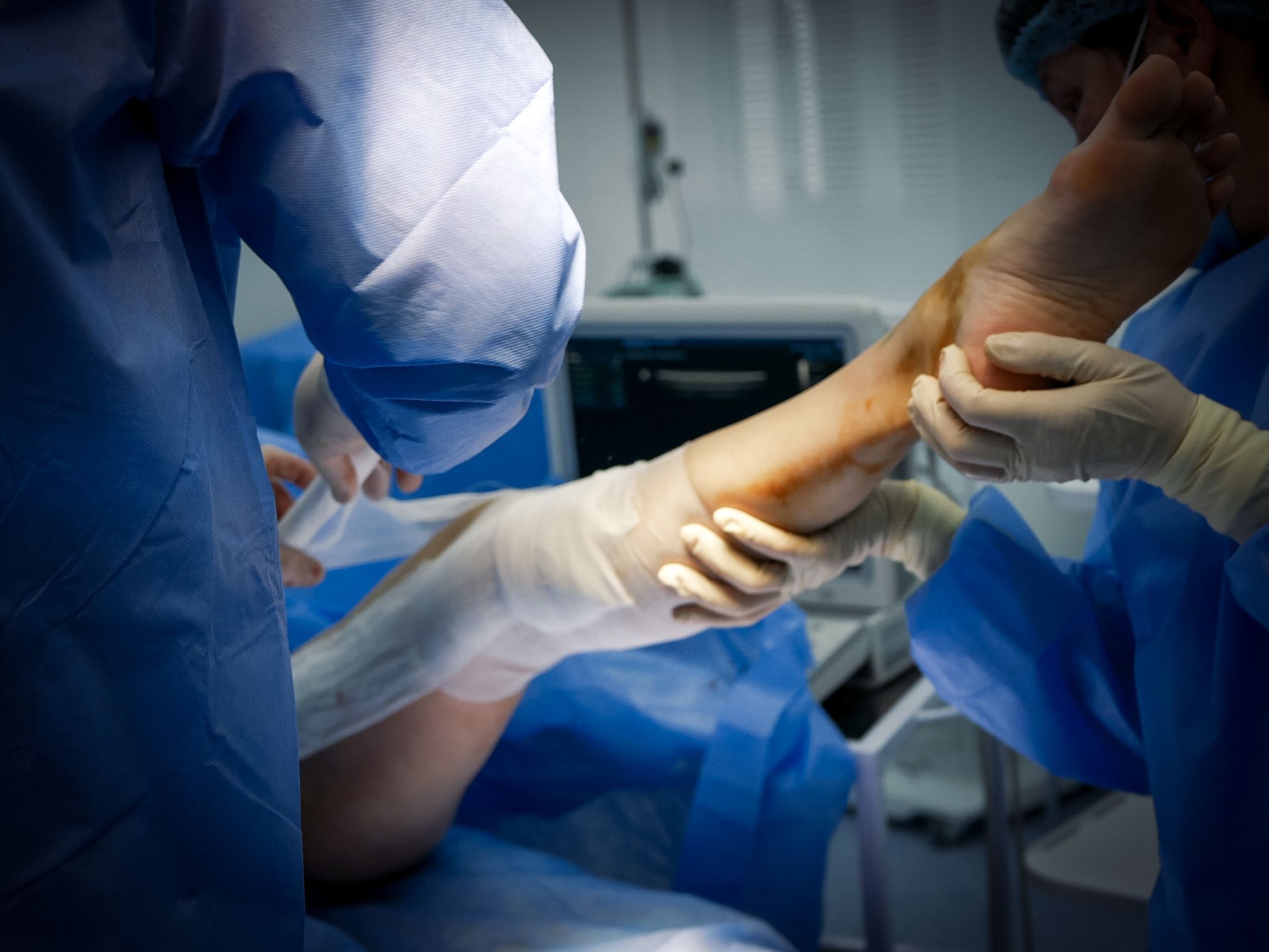 Equipe médica em cirurgia ortopédica de joelho após plano de saúde negar artroplastia